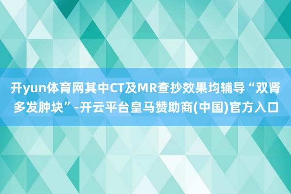 开yun体育网其中CT及MR查抄效果均辅导“双肾多发肿块”-开云平台皇马赞助商(中国)官方入口